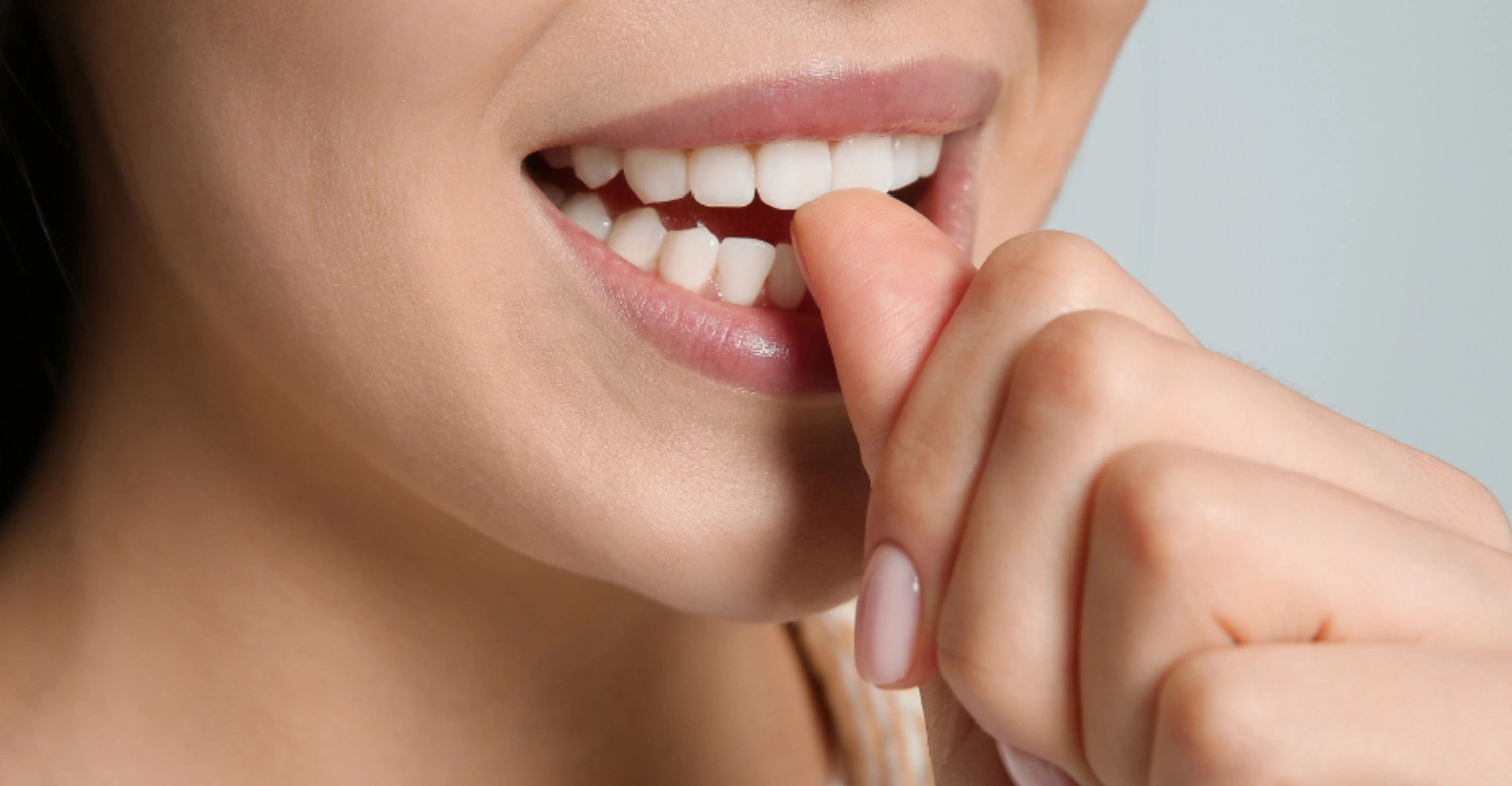 Nail Biting Teeth 2